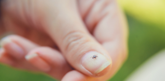 how to prevent ticks