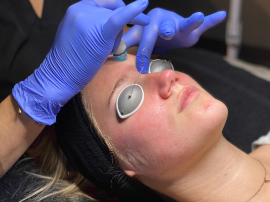 fargo dermatologist