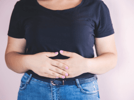 diastasis recti